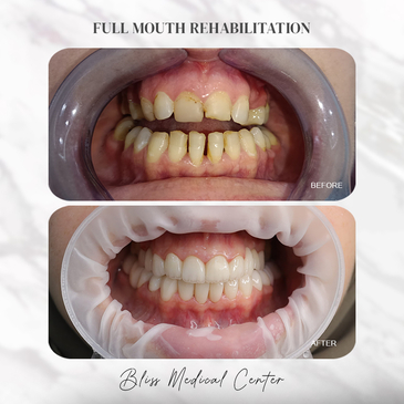 Slider image (2) Bliss Medical Centre Ajman, Jurf